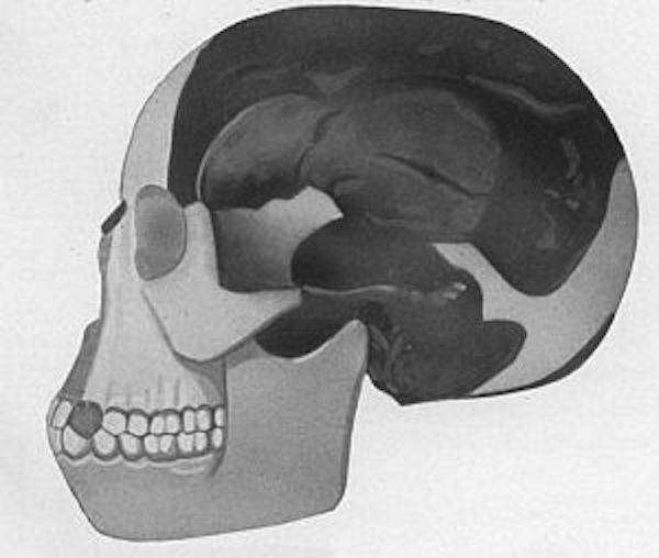 Le crâne de l'homme de Piltdown, reconstitution - source : WikiCommons