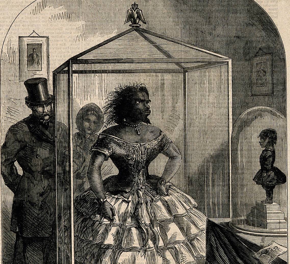 Exhibition du cadavre embaumé de Julia Pastrana ainsi que celui de son nourrisson mort-né, 1860 - source : WikiCommons